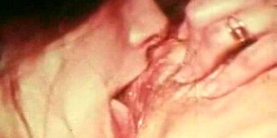 Vintage Lesbian hirsute of course